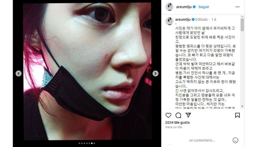 Denuncia de Areum de T-ARA